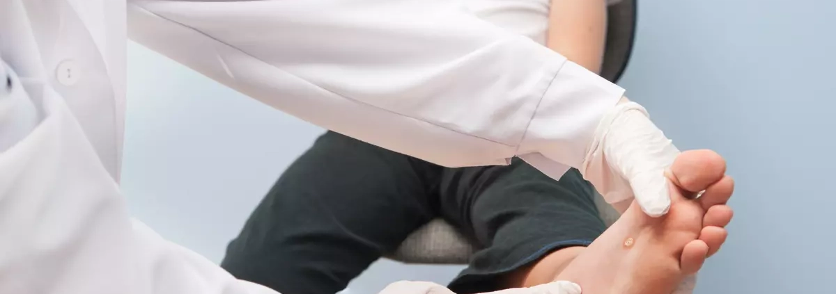 Verruche e molluschi contagiosi