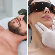 Epilazione laser con laser Alessandrite